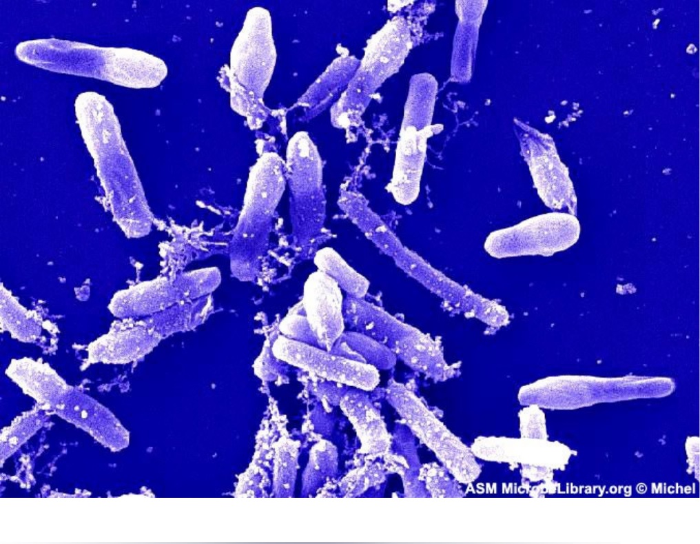 Bakteri-Thiobacillus